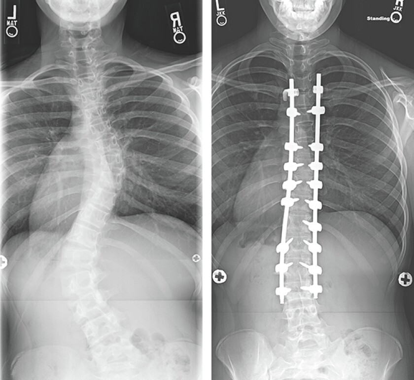 2314857+Xrays.jpg