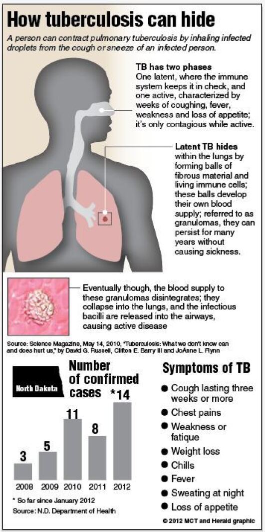 Mesmerizing Tb Outbreak In Malaysia: Is There A Need To Defer Travel Plans? Wallpaper Collection Mesmerizing Tb Outbreak In Malaysia: Is There A Need To Defer Travel Plans? Wallpaper Collection