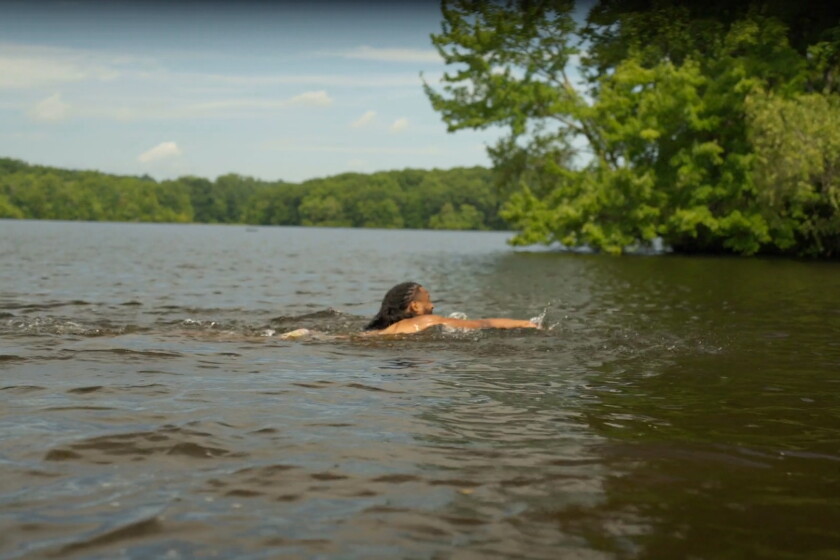 Swimmers Rash Lake Swimmer’s itch treatment starts early in Detroit Lakes - InForum ...