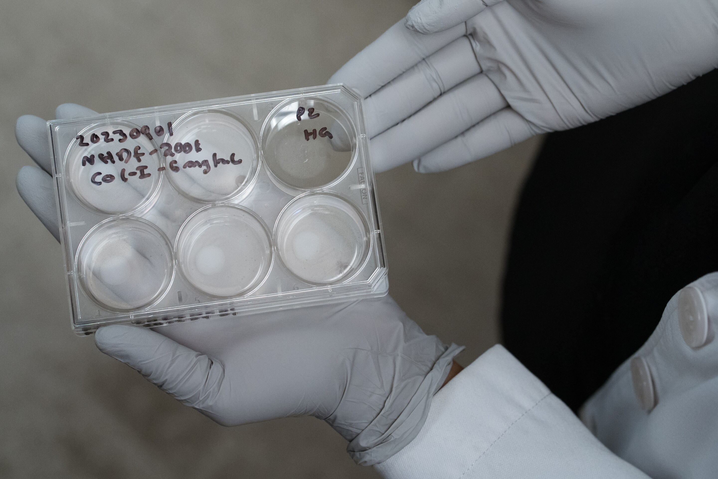 Mayo Clinic dermatology lab makes 3D bioprinted skin for eczema ...