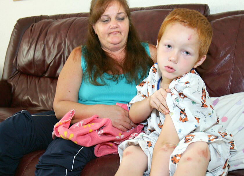 A young boy in pajamas lifts his sleeve to show bruises while a woman sits next to him