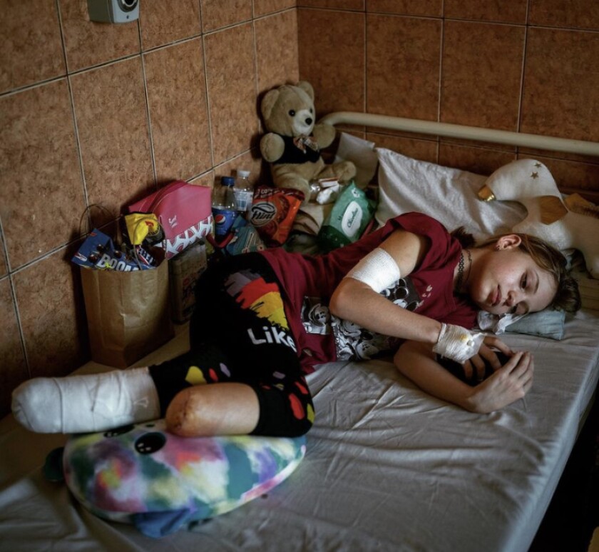 An adolescent girl with legs ending in stumps lays in a bed surrounded by stuffed animals.