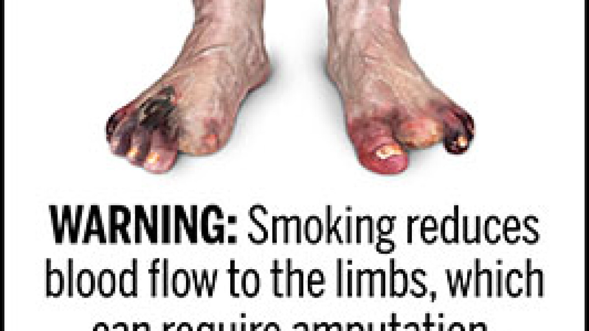 feet cigarettes Lighting up could soon become gruesome: FDA releases proposed images for  cigarette packaging