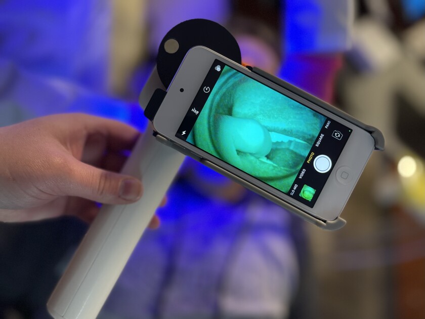 Utilizing a specialized light — blue light causes stimulation of the epithelial cells with areas of abnormality appearing darker in color — the VELscope, pictured above, is able to identify a variety of abnormalities including oral cancer two years sooner.