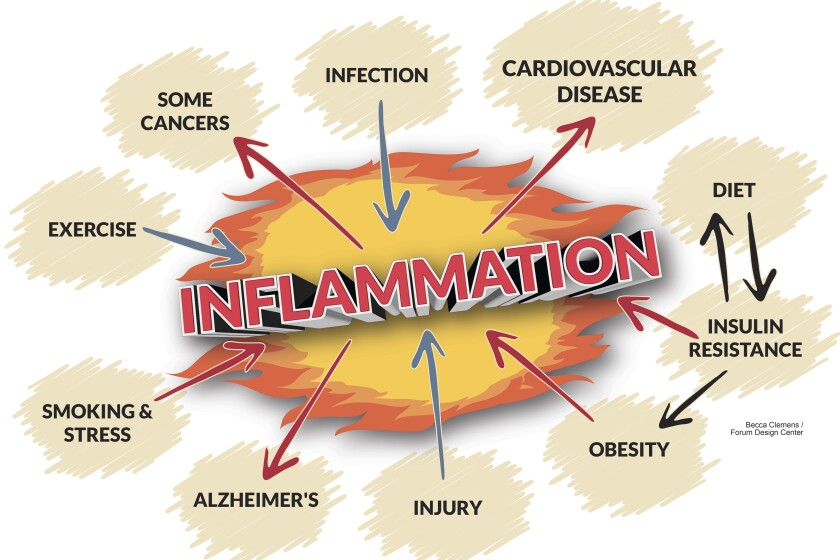 The good news, and bad news, of inflammation - Duluth News Tribune | News, weather, and sports from Duluth, Minnesota