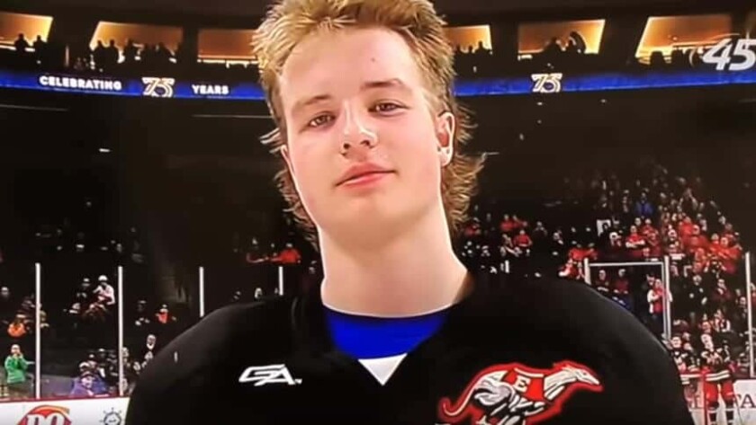031119hockeyhair