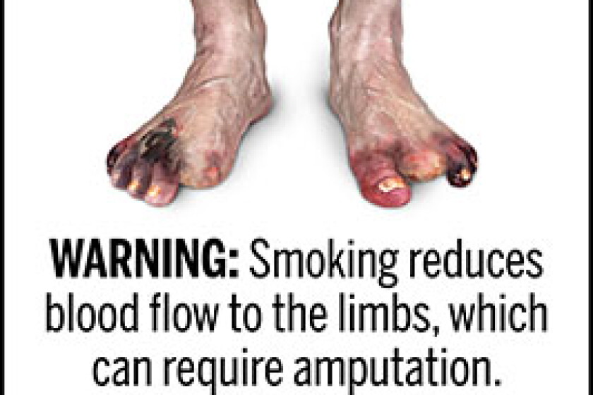 cigarette foot Lighting up could soon become gruesome: FDA releases proposed images for  cigarette packaging - Alexandria Echo Press