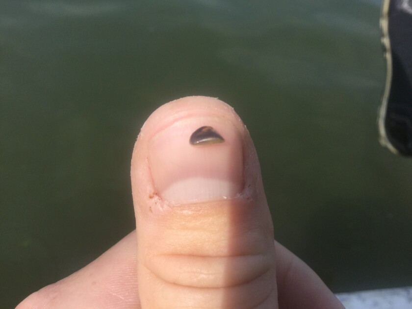 Minnesota DNR courtesy image The Minnesota Department of Natural Resources released this image of a zebra mussel found in Eagle Lake. The DNR has now listed the lake as among 10 in Kandiyohi County infested by the invasive aquatic species.