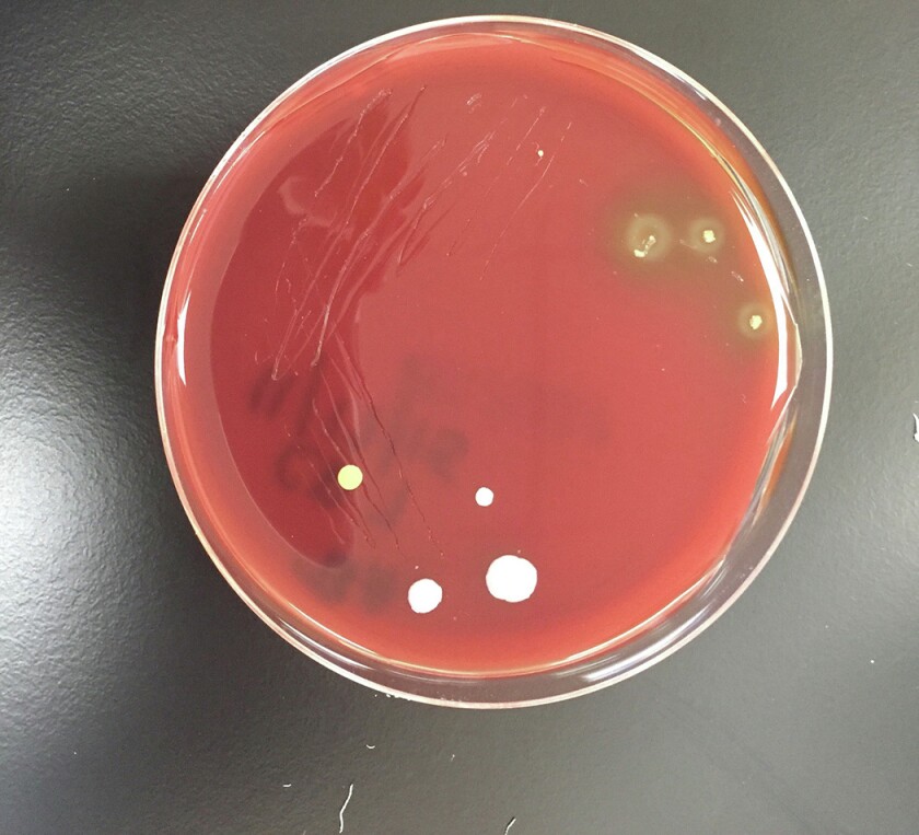 2211129+A2BacteriaBW.jpg