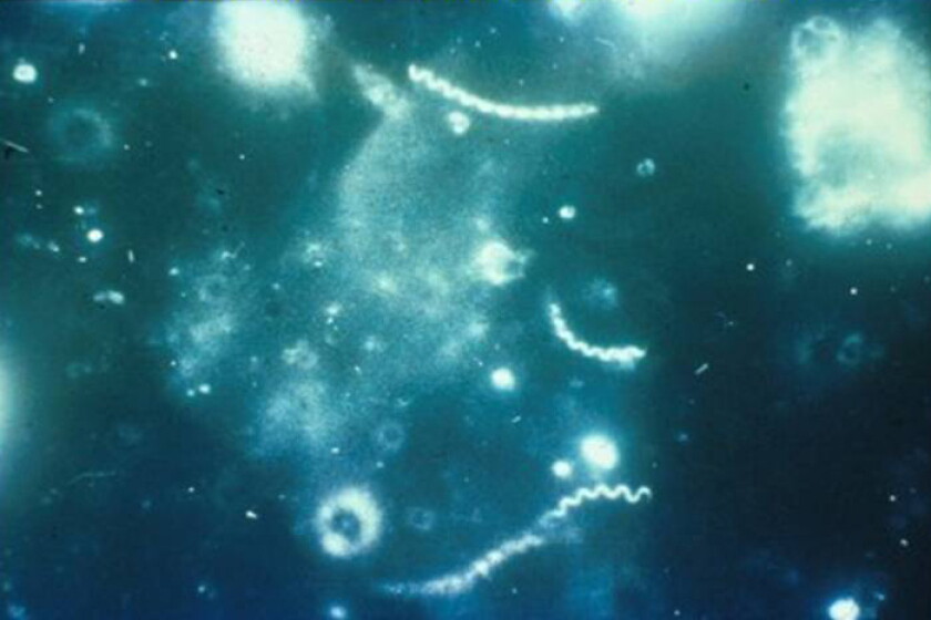 Cdc Spirocy Reports of many STDs fell in North Dakota in 2020 — but not all