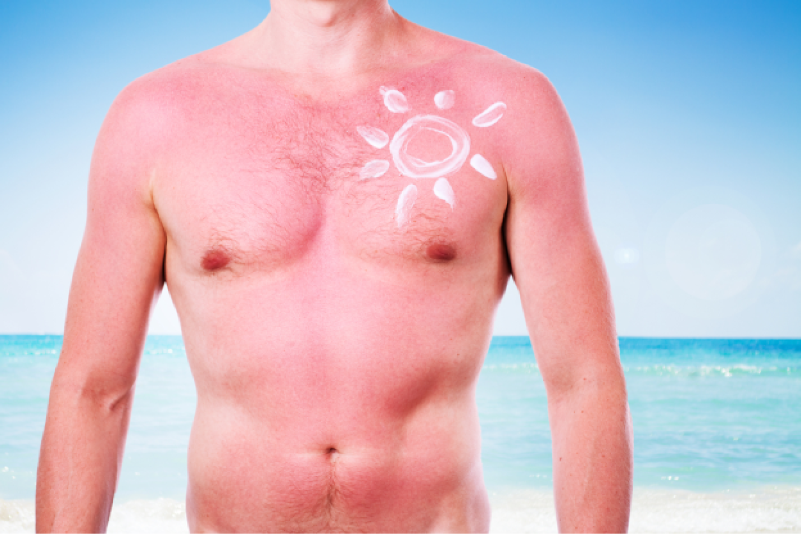 Doctor warns against 'sunburn tattoo' fad Duluth News Tribune News