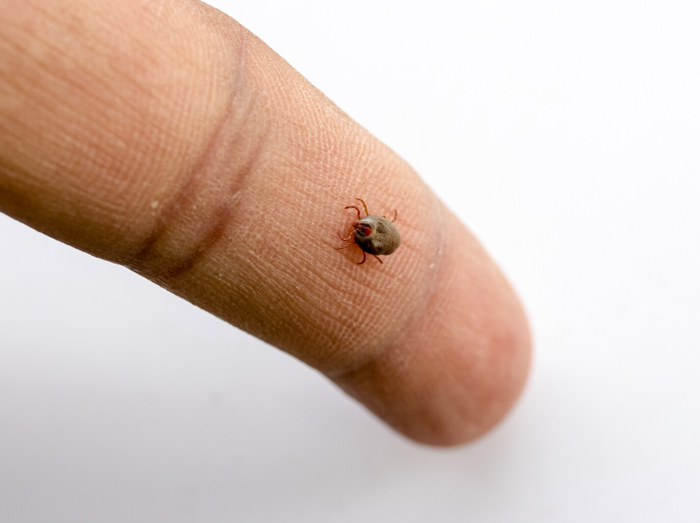 Ticks Post Tick-borne disease on the rise in Minnesota, other northern states ...