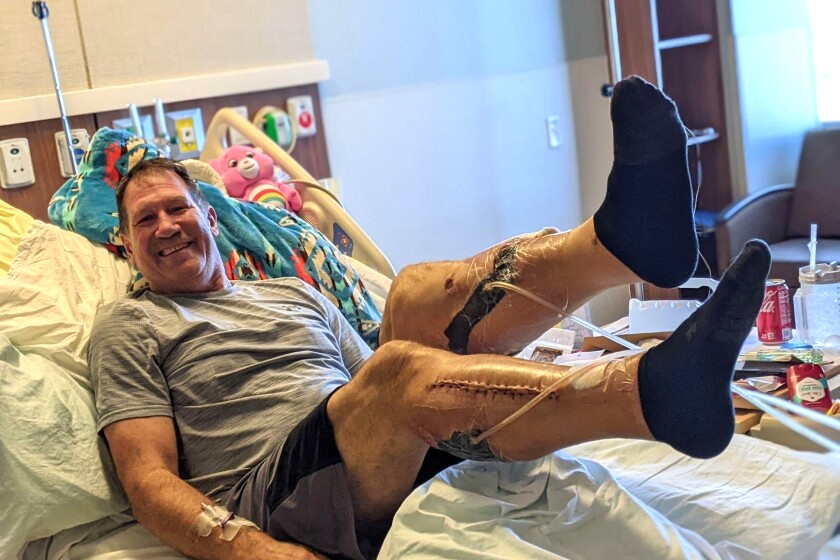 Jawaski_Jim shows off his recovering legs from his hospital bed in Fargo, Fall 2023.jpg
